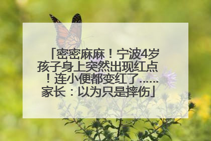 密密麻麻！宁波4岁孩子身上突然出现红点！连小便都变红了……家长：以为只是摔伤